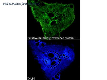 HUABIO EM1701-51 image 1