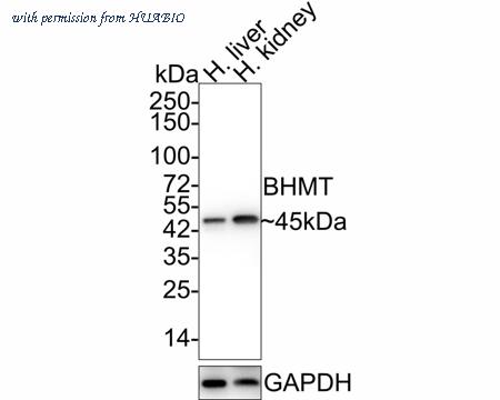 HUABIO EM1701-64 image 1