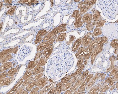 HUABIO EM1701-64 image 2