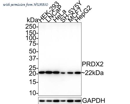 HUABIO EM1701-72 image 1