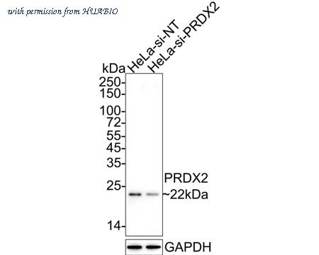 HUABIO EM1701-72 image 2
