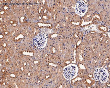 HUABIO EM1701-72 image 3