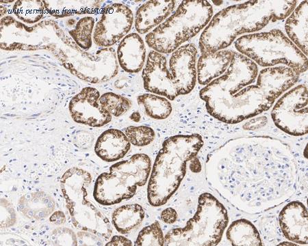 HUABIO EM1701-74 image 3