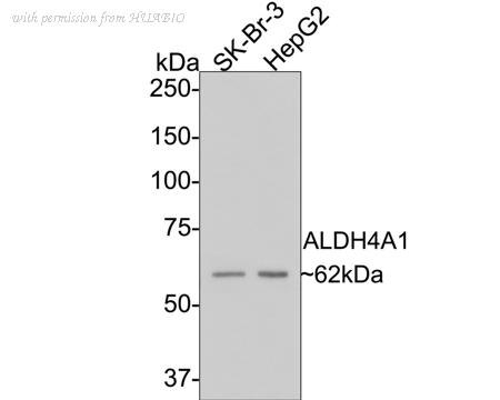 HUABIO EM1701-75 image 1