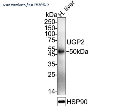 HUABIO EM1701-76 image 1