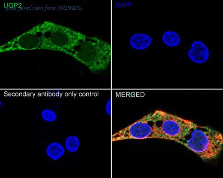 HUABIO EM1701-76 image 2