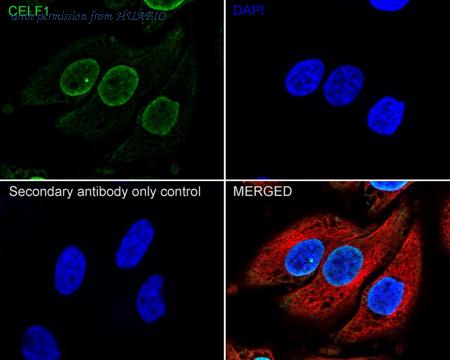 HUABIO EM1701-77 image 2