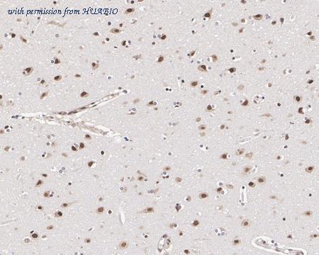 HUABIO EM1701-77 image 3