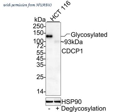 HUABIO EM1701-84 image 2