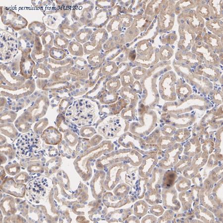 HUABIO EM1701-98 image 2