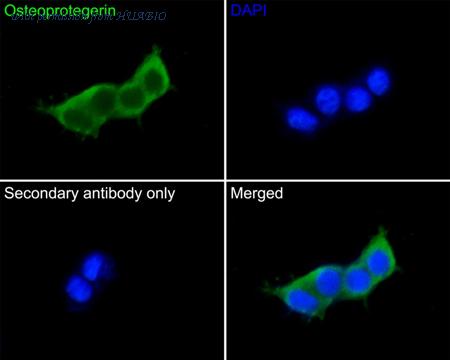 HUABIO EM1701-99 image 2