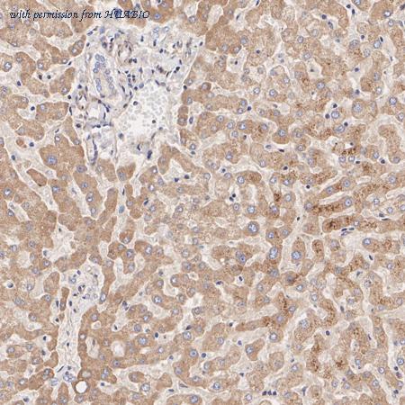 HUABIO EM1701-99 image 3