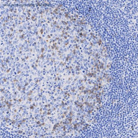 HUABIO EM1707-60 image 2