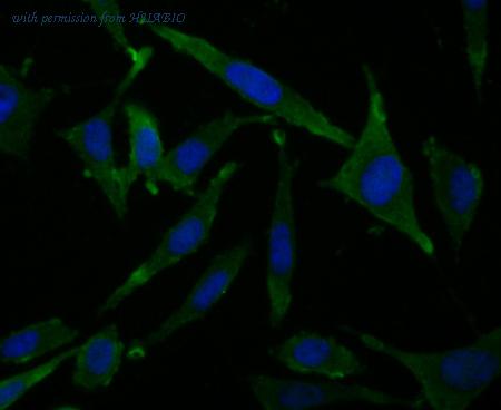 HUABIO EM1901-04 image 2