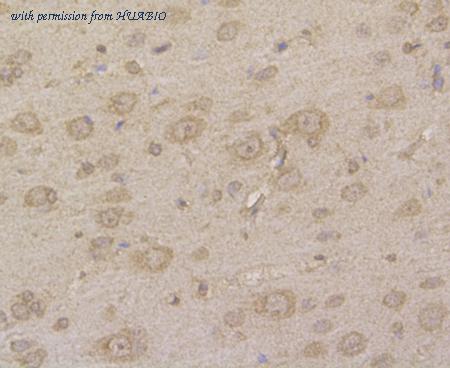 HUABIO EM1901-04 image 3