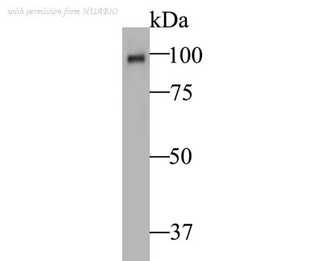 HUABIO EM1901-05 image 1