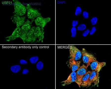 HUABIO EM1901-37 image 2