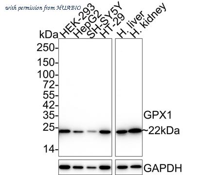 HUABIO EM1901-56 image 1