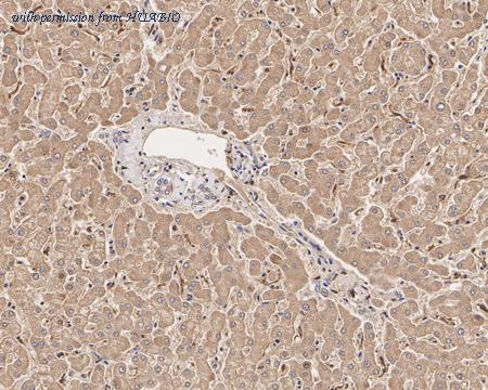 HUABIO EM1901-56 image 3