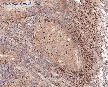 HUABIO EM1901-57 image 2