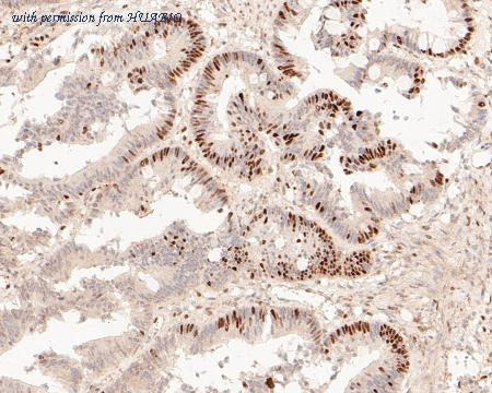 HUABIO EM1901-57 image 3