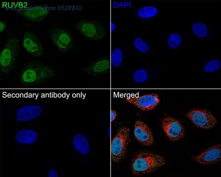HUABIO EM1901-58 image 2