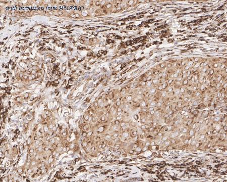 HUABIO EM1901-60 image 3