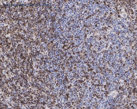 HUABIO EM1901-70 image 2