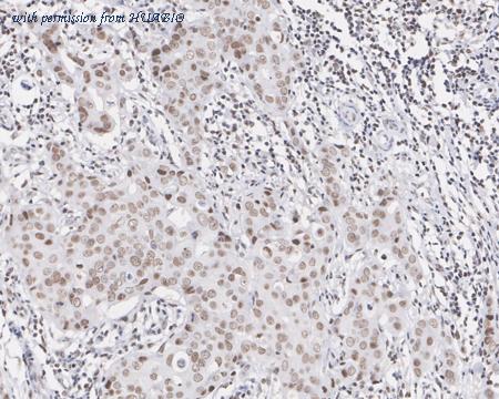 HUABIO EM1901-74 image 2