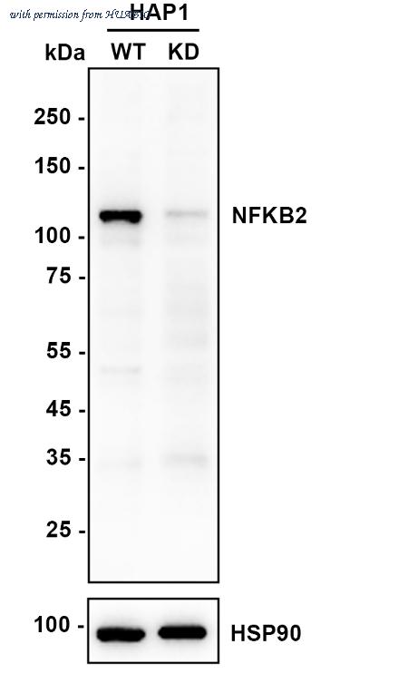 HUABIO EM1901-78 image 1