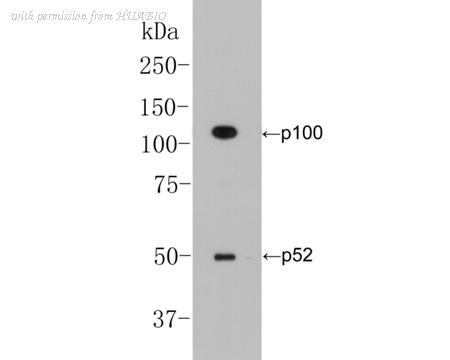 HUABIO EM1901-78 image 2