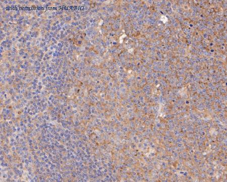 HUABIO EM1901-78 image 3