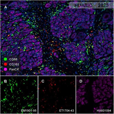 HUABIO EM1901-95 image 2