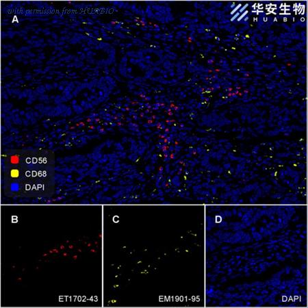 HUABIO EM1901-95 image 3