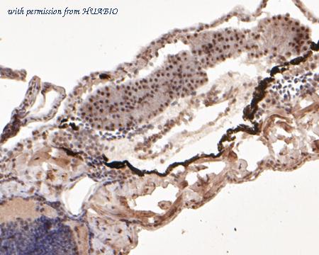 HUABIO EM1902-04 image 1