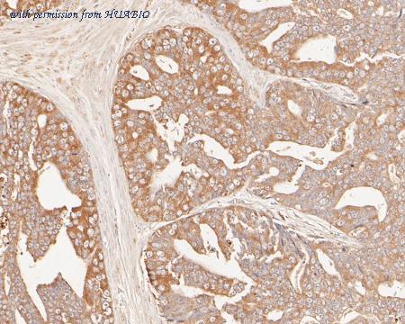 HUABIO EM1902-26 image 3