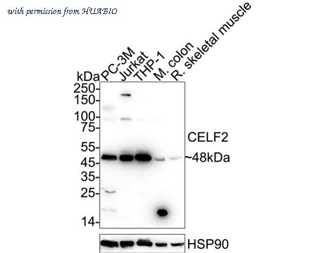 HUABIO EM1902-41 image 1