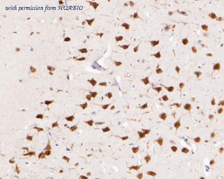 HUABIO EM1902-41 image 2