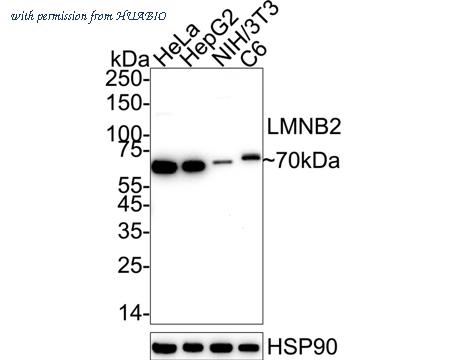 HUABIO ER0403 image 1