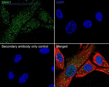 HUABIO ER1706-22 image 2