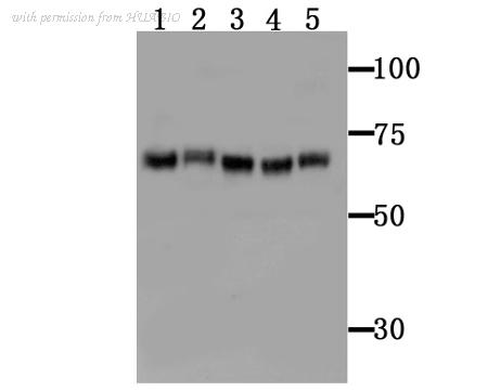 HUABIO ER1706-28 image 1