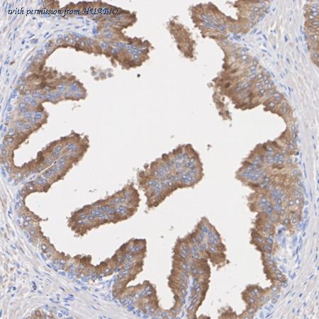 HUABIO ER1706-31 image 1