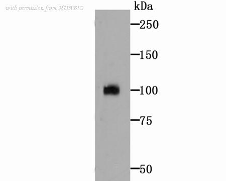 HUABIO ER1706-34 image 1