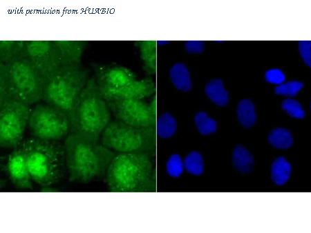 HUABIO ER1706-34 image 3