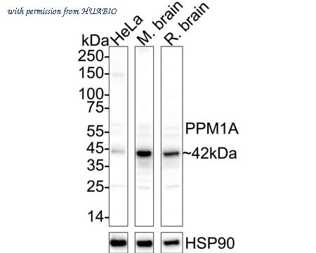 HUABIO ER1706-37 image 1