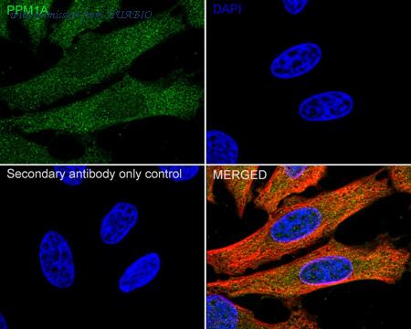 HUABIO ER1706-37 image 2