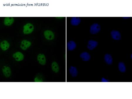 HUABIO ER1706-38 image 2