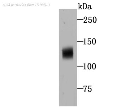 HUABIO ER1706-45 image 1