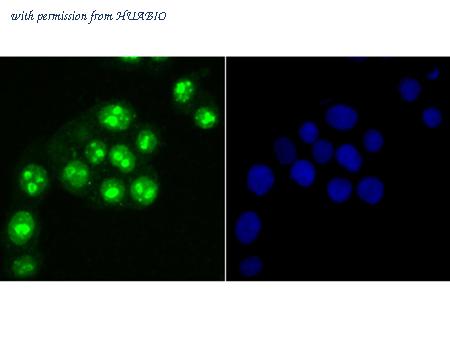 HUABIO ER1706-46 image 3