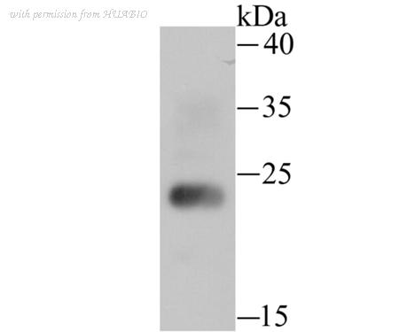 HUABIO ER1706-52 image 2